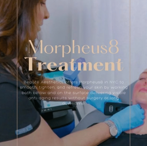 The complete Morpheus8 aftercare guide for NYC patients